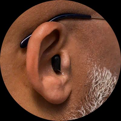 Close-up of a hearing aid worn in the ear